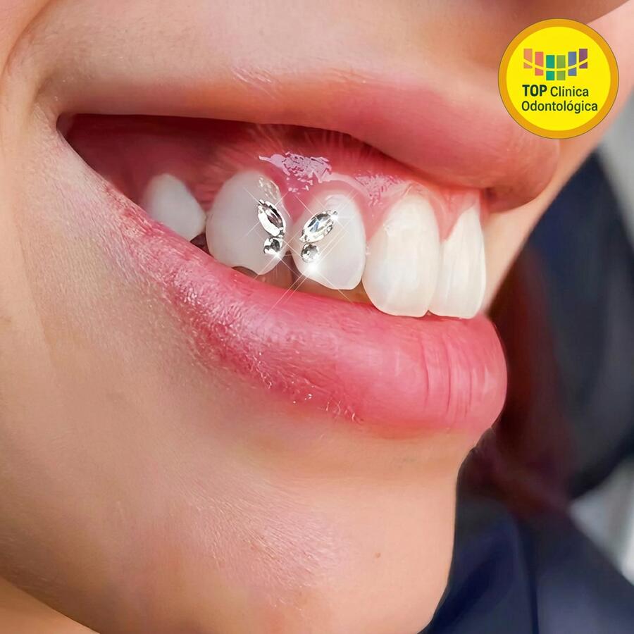 Joia dental